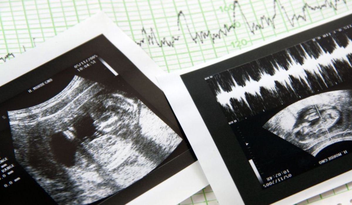 В Омской области девять частных клиник прекратили проведение абортов